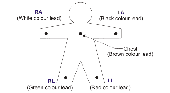ECG Lead System Configuration 导联系统配置