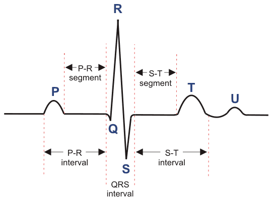 ECG Recording Setup (Block Diagram and Waveform) 心电图记录装置(方框图和波形)